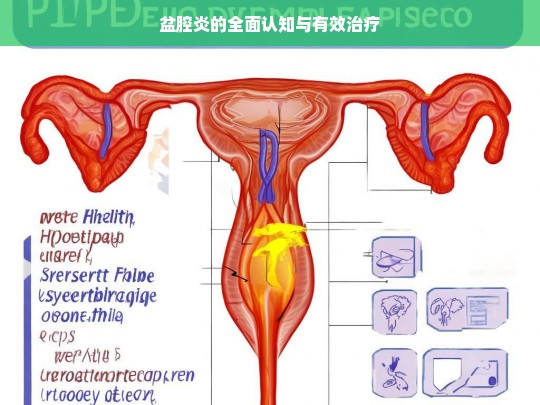 盆腔炎的全面认知与有效治疗，盆腔炎，认知与治疗全攻略