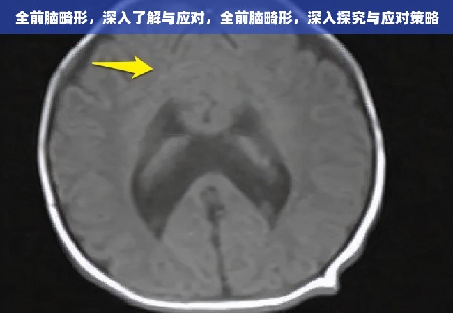 全前脑畸形，深入了解与应对，全前脑畸形，深入探究与应对策略